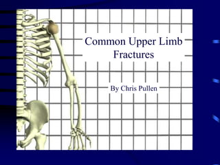 Common Upper Limb Fractures By Chris Pullen 