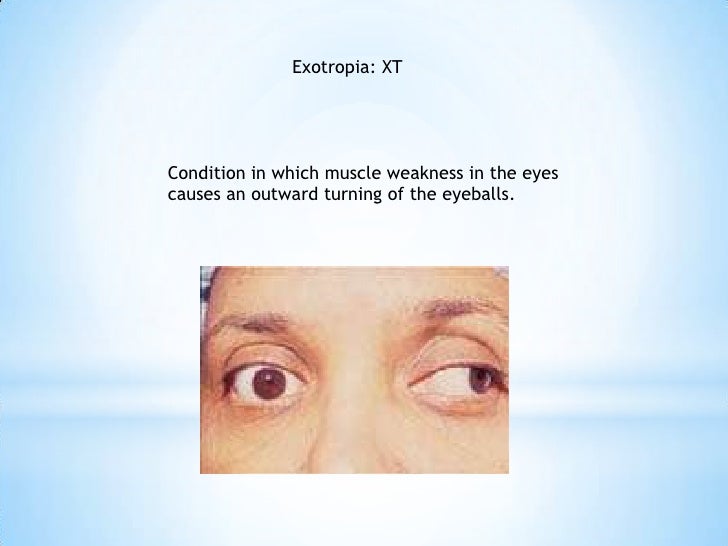 Common abbreviations for eyes and ears