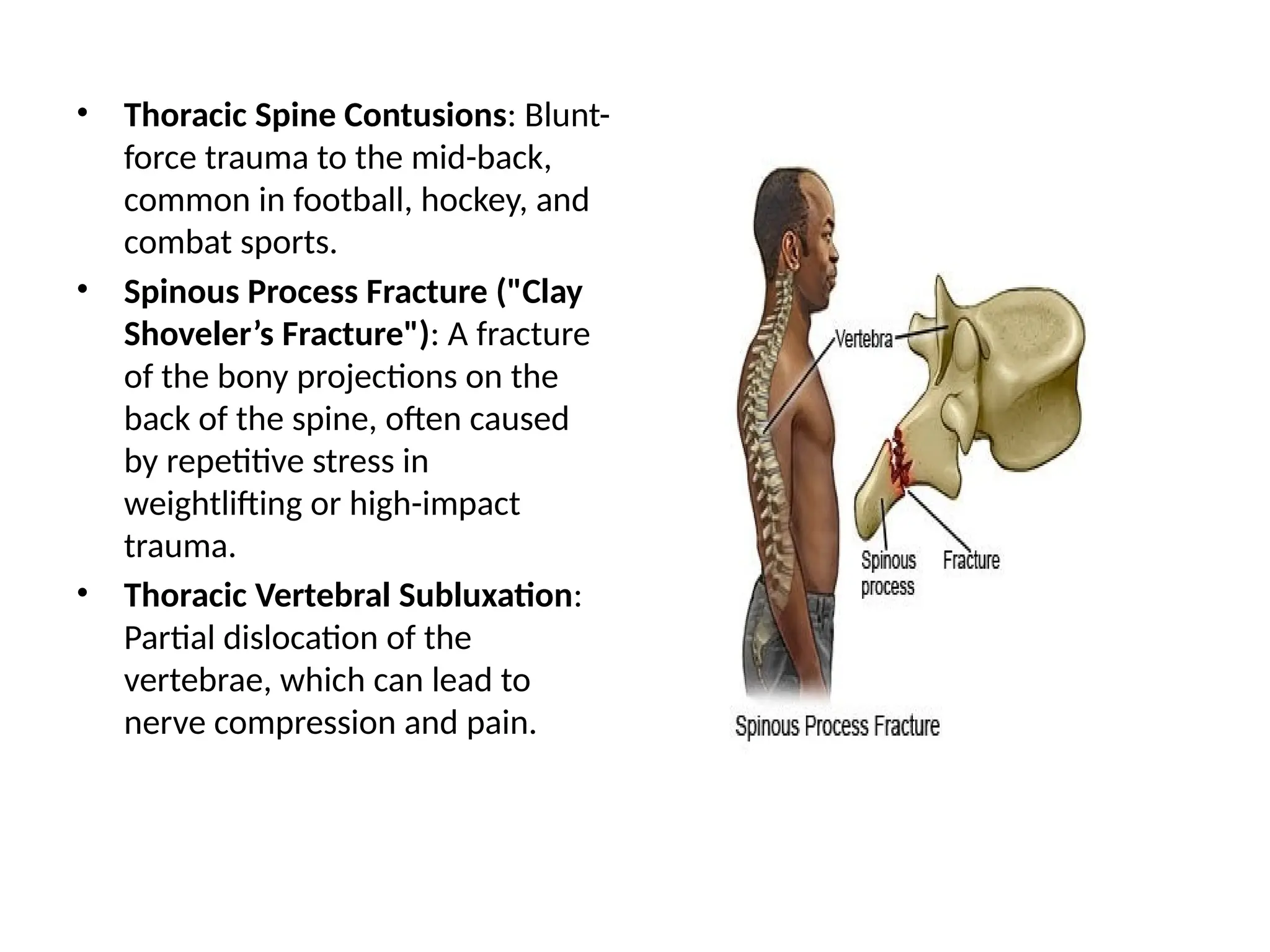 Common acute and overuse injuries of spine.pptx
