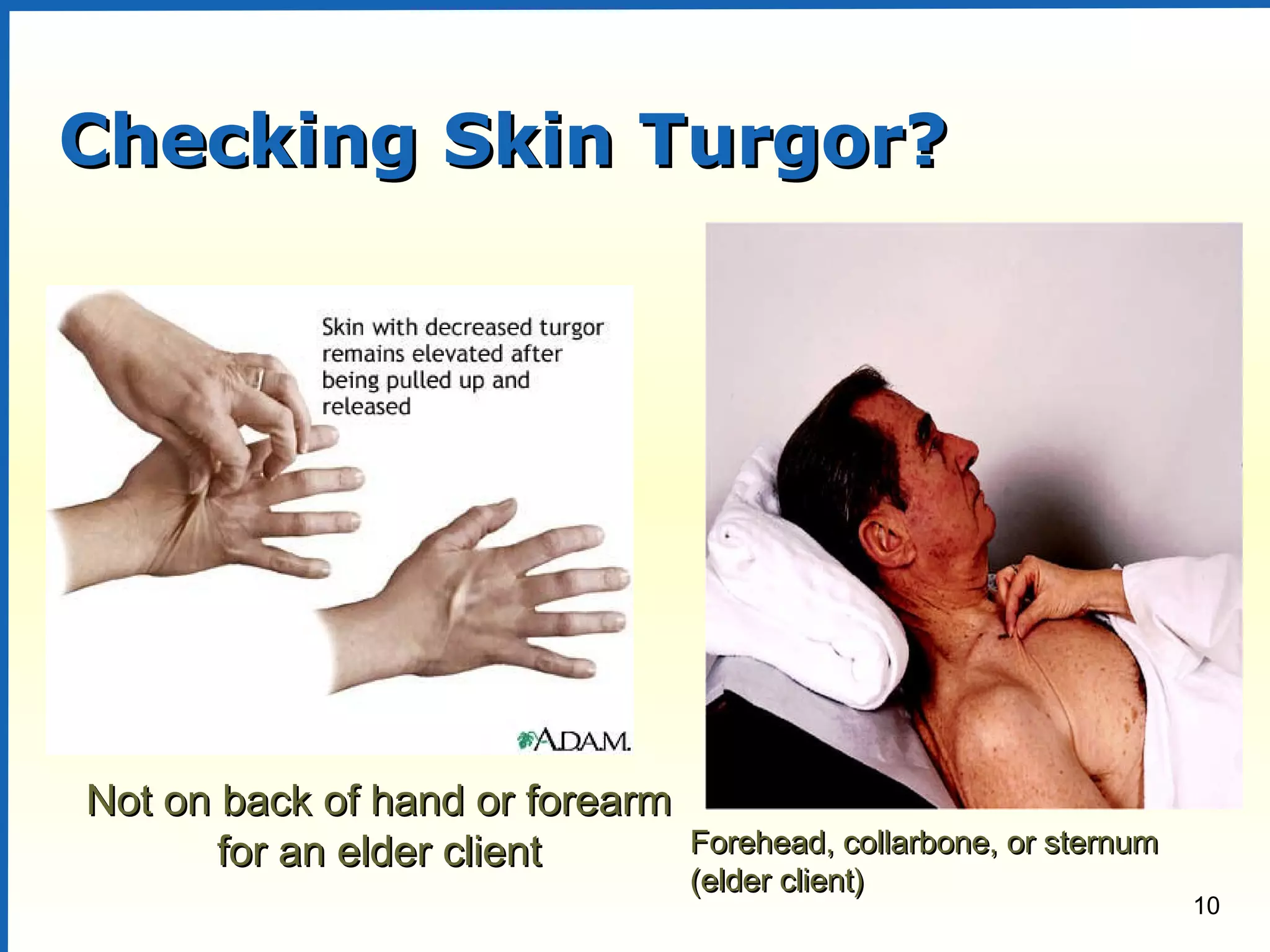 10
Checking Skin Turgor?Checking Skin Turgor?
Forehead, collarbone, or sternumForehead, collarbone, or sternum
(elder client)(elder client)
Not on back of hand or forearmNot on back of hand or forearm
for an elder clientfor an elder client
 