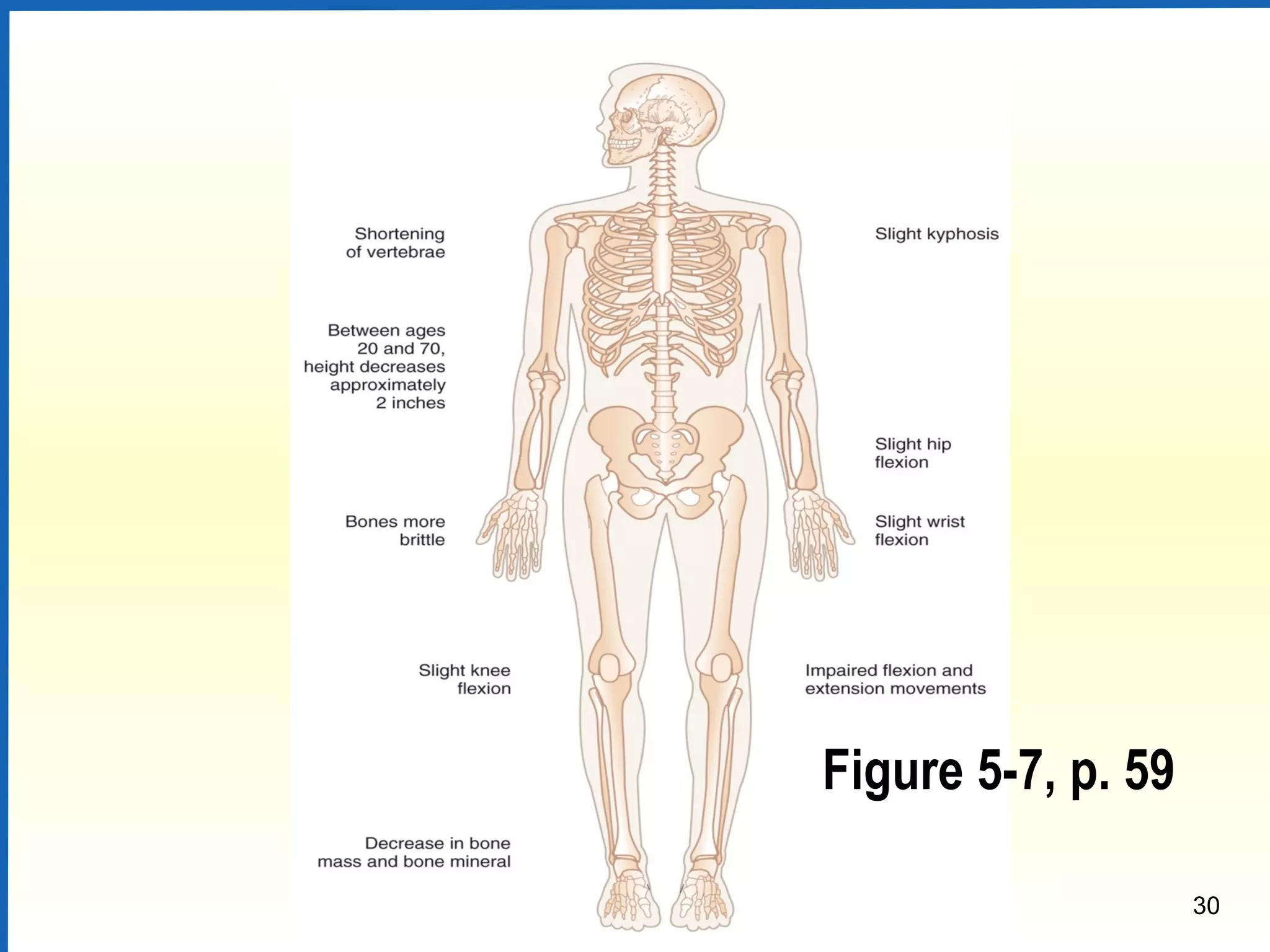 30
Figure 5-7, p. 59
 