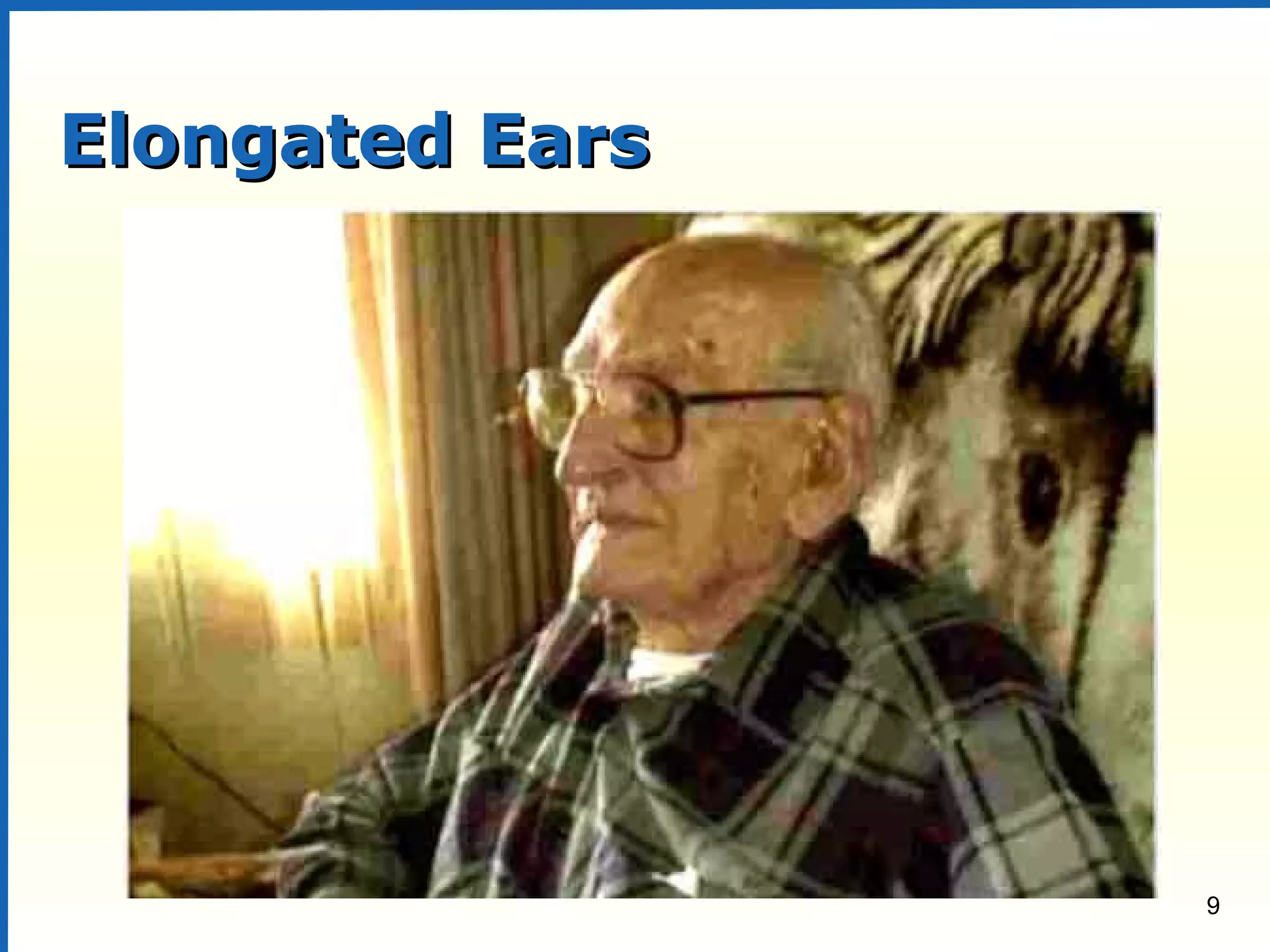 9
Elongated EarsElongated Ears
 