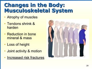 Common aging changes_spring 2014 abridged | PPT