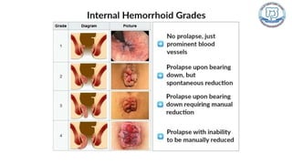 Common anal conditions.