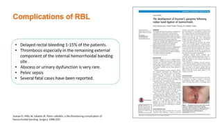 Common anal conditions.
