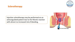 Common anal conditions.