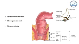 Common anal conditions.