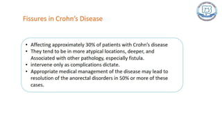 Common anal conditions.