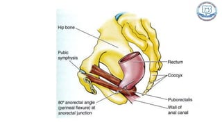 Common anal conditions.
