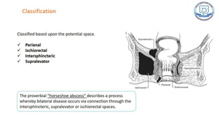 Common anal conditions.