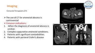 Common anal conditions.