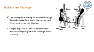 Common anal conditions.
