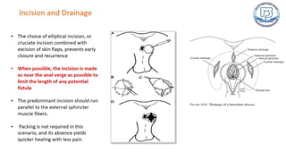 Common anal conditions.