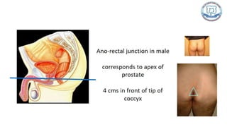 Common anal conditions.