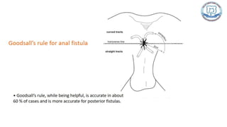 Common anal conditions.
