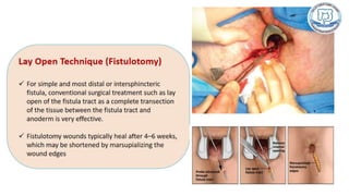 Common anal conditions.