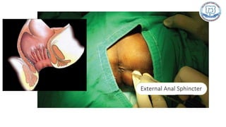 Common anal conditions.