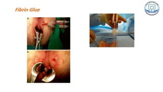 Common anal conditions.