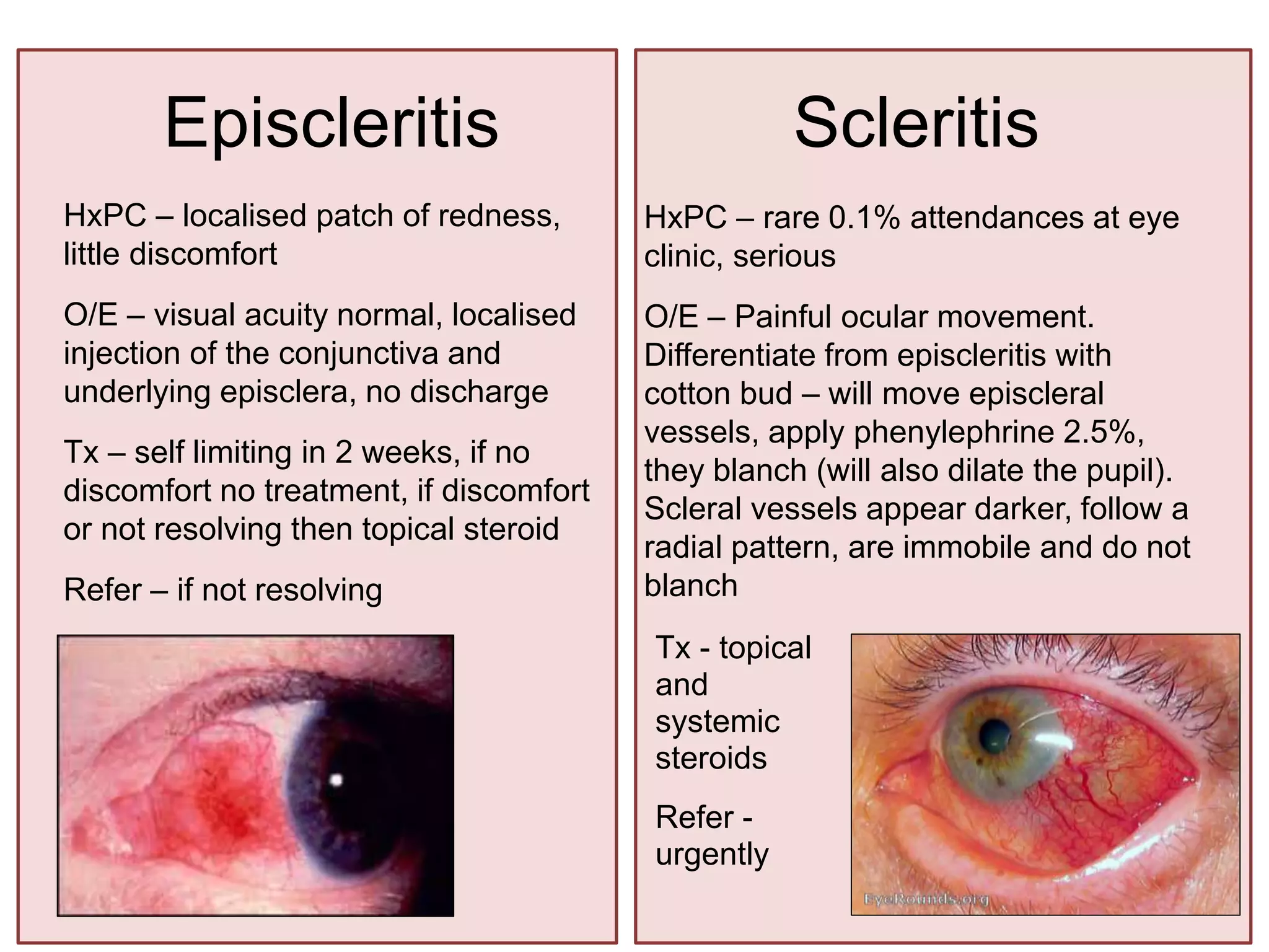 Eye Presentations To The Emergency Department PPTX