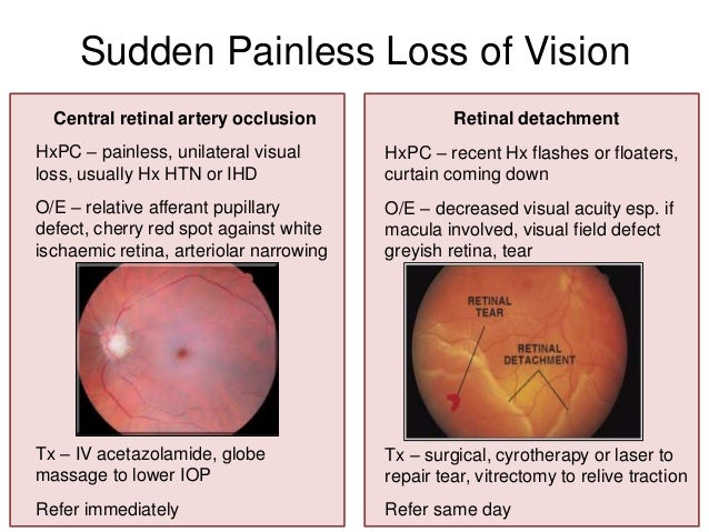 Eye Presentations To The Emergency Department