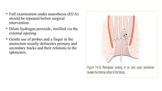 Common Anorectal Problems and its management.pptx
