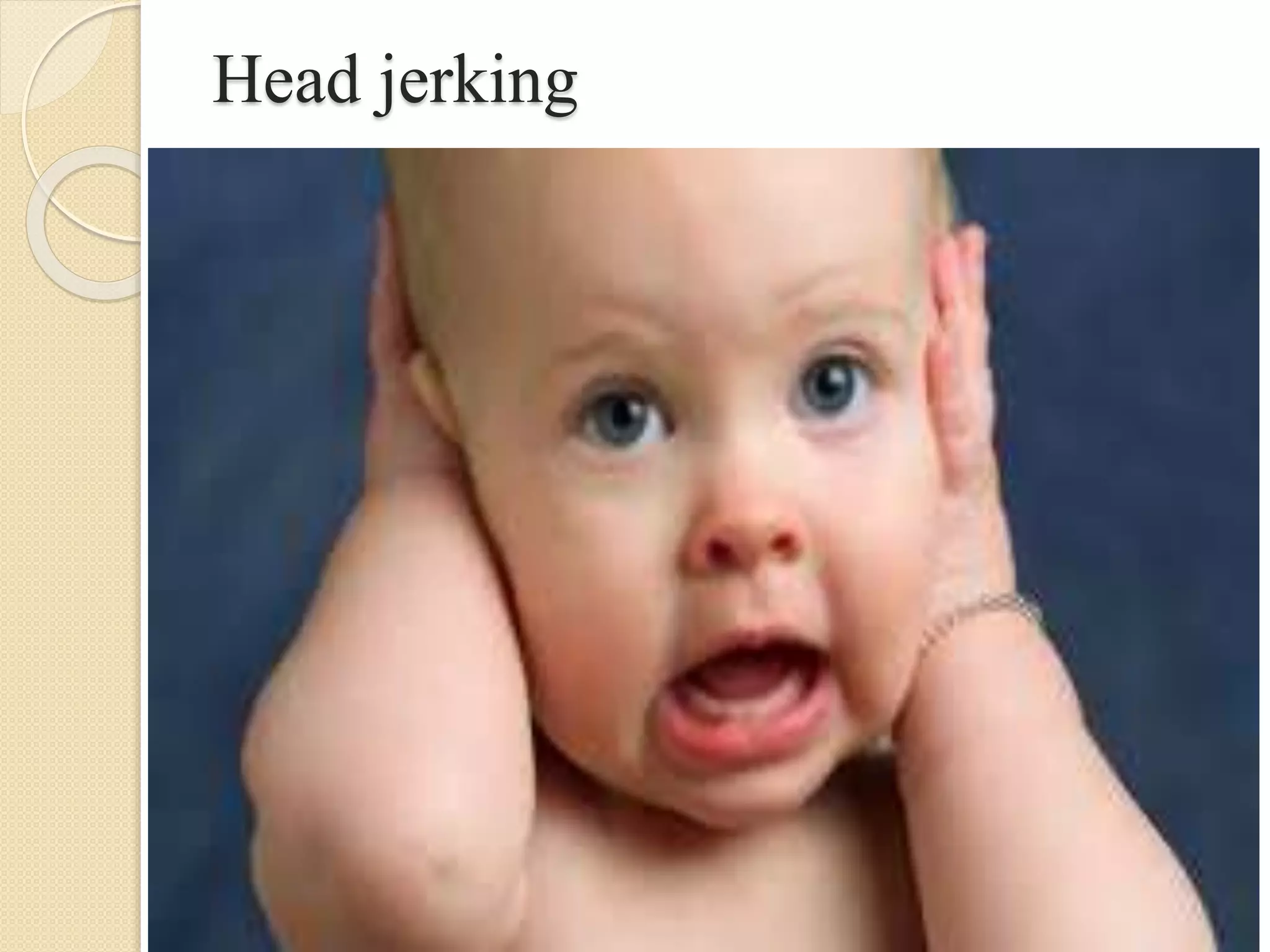 Head jerking
 