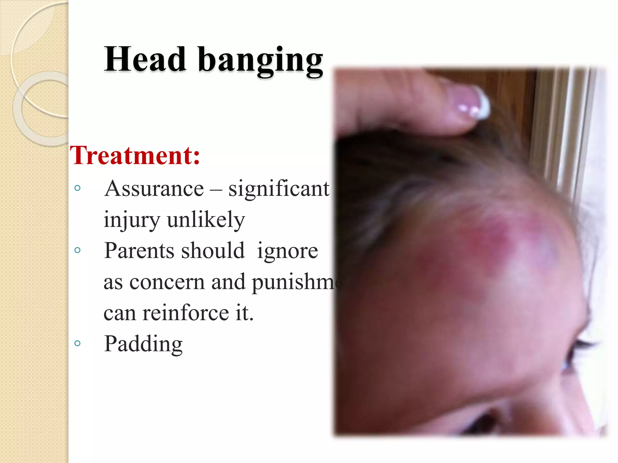 Head banging
Treatment:
◦ Assurance – significant
injury unlikely
◦ Parents should ignore
as concern and punishment
can reinforce it.
◦ Padding
 