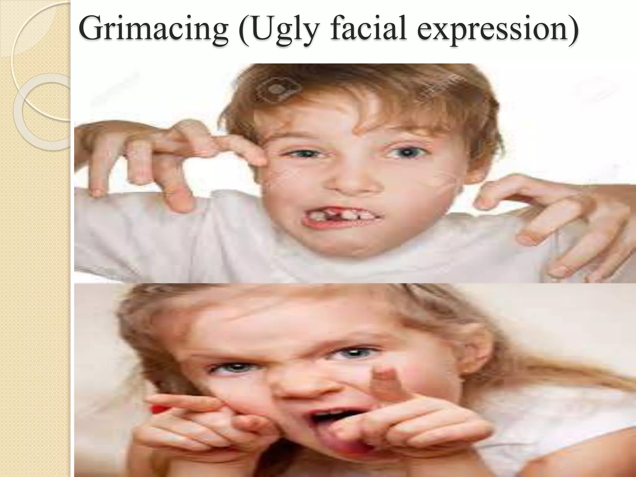 Grimacing (Ugly facial expression)
 