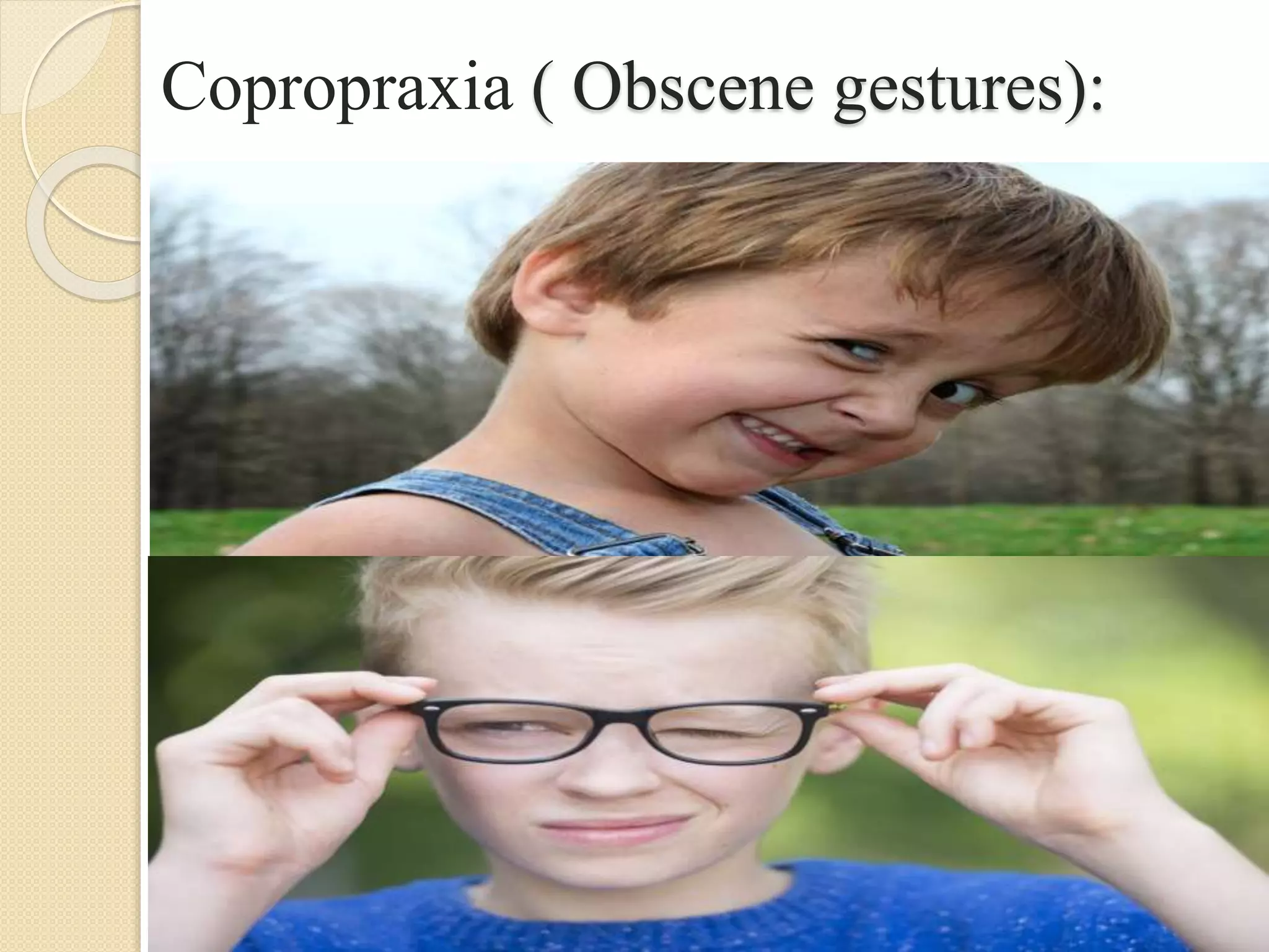 Copropraxia ( Obscene gestures):
 