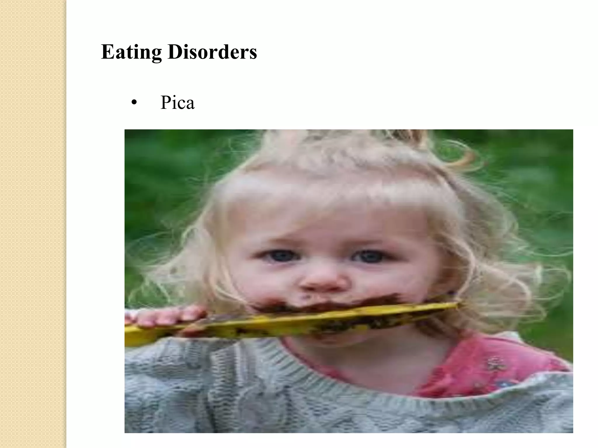 Eating Disorders
• Pica
 