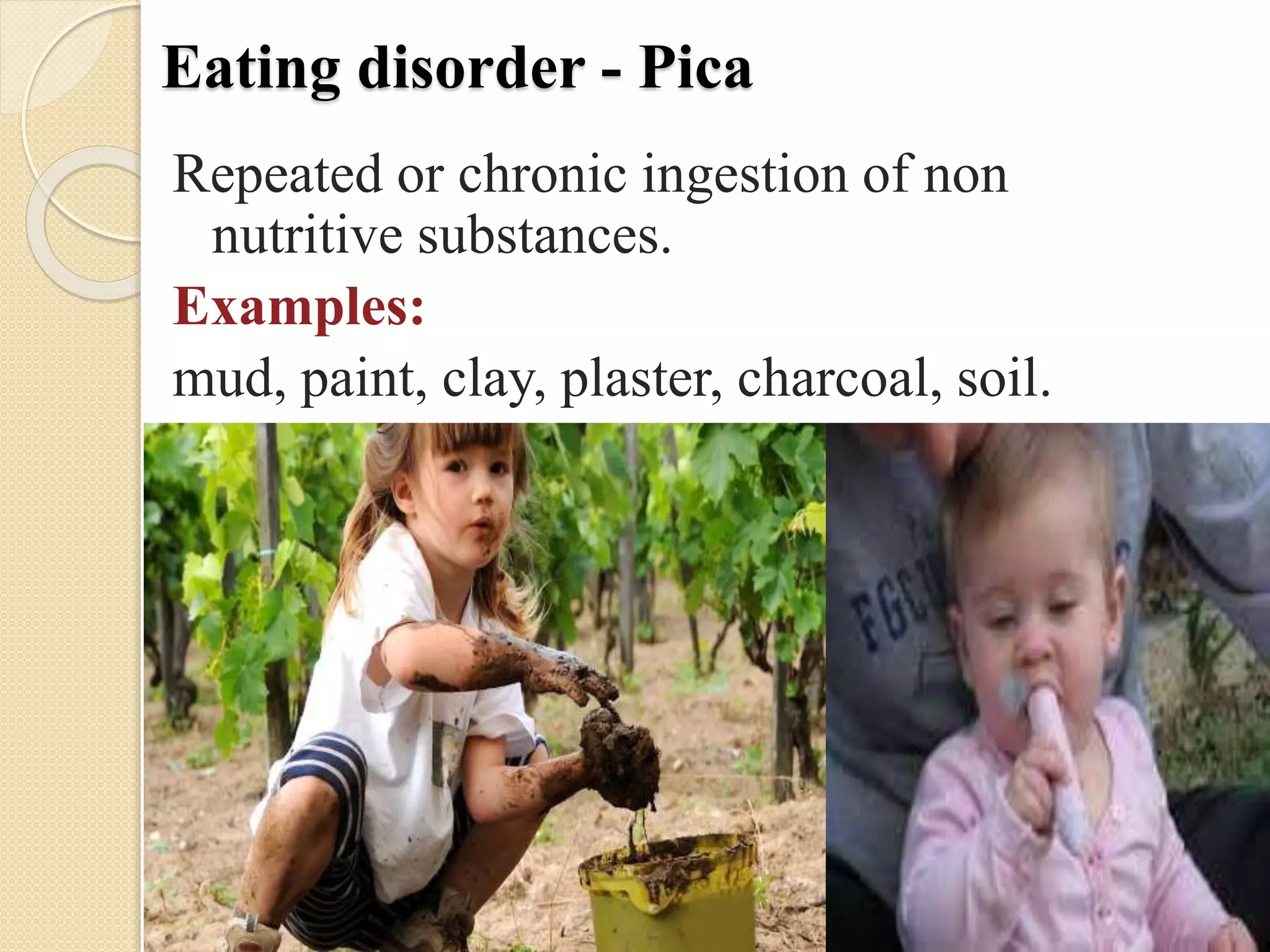 Eating disorder - Pica
Repeated or chronic ingestion of non
nutritive substances.
Examples:
mud, paint, clay, plaster, charcoal, soil.
 
