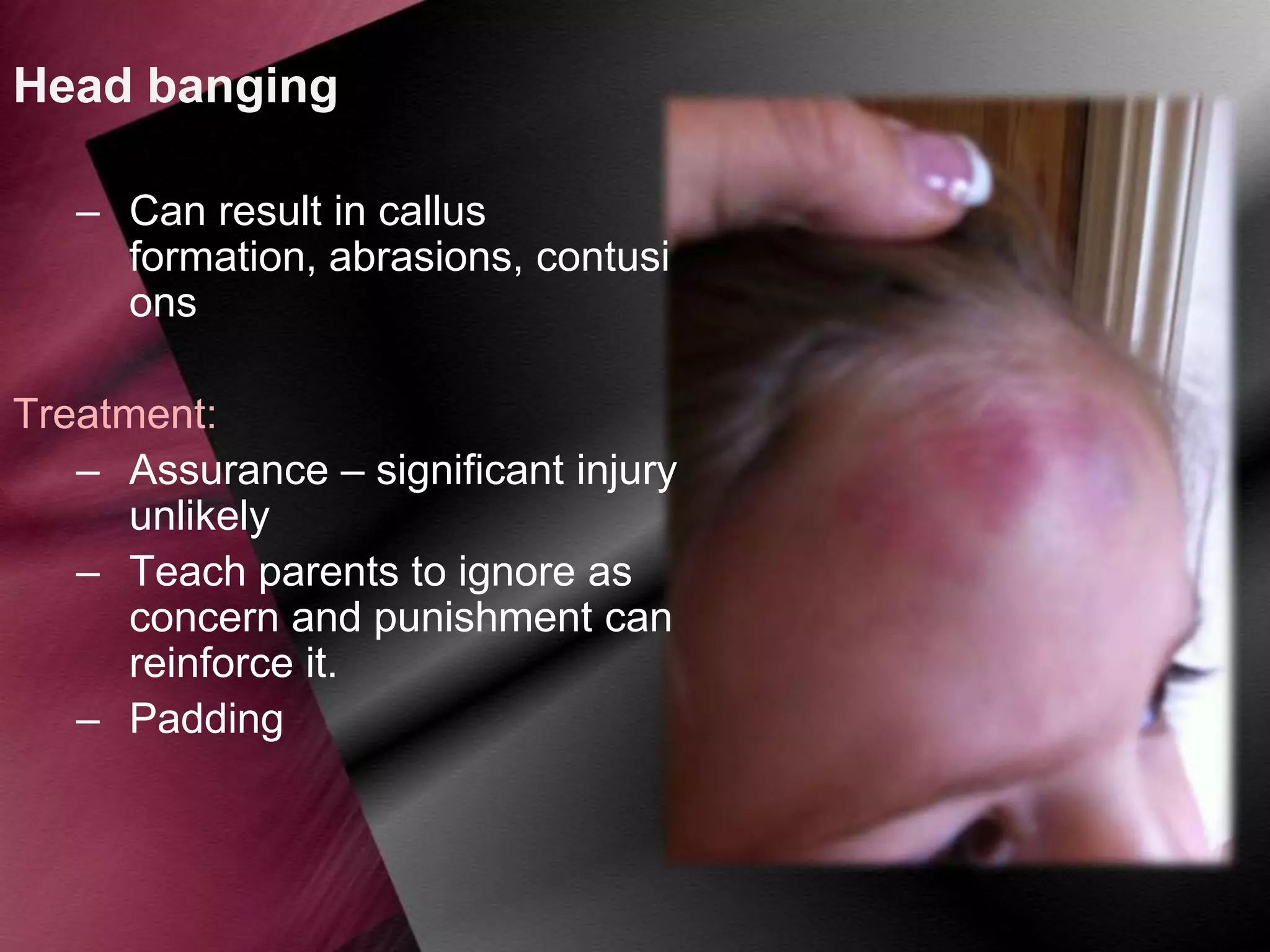 Head banging
– Can result in callus
formation, abrasions, contusi
ons
Treatment:
– Assurance – significant injury
unlikely
– Teach parents to ignore as
concern and punishment can
reinforce it.
– Padding

 