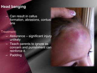 Head banging
– Can result in callus
formation, abrasions, contusi
ons
Treatment:
– Assurance – significant injury
unlikely
– Teach parents to ignore as
concern and punishment can
reinforce it.
– Padding

 