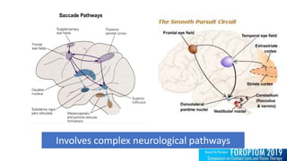 Involves complex neurological pathways
 