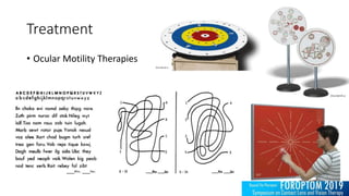 Treatment
• Ocular Motility Therapies
 