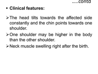 …..contd
 Clinical features:
The head tilts towards the affected side
constantly and the chin points towards one
shoulder.
One shoulder may be higher in the body
than the other shoulder.
Neck muscle swelling right after the birth.
 