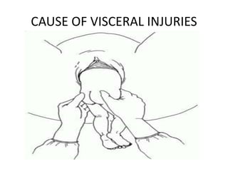 CAUSE OF VISCERAL INJURIES
 