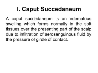 I. Caput Succedaneum
A caput succedaneum is an edematous
swelling which forms normally in the soft
tissues over the presenting part of the scalp
due to infiltration of serosanguinous fluid by
the pressure of girdle of contact.
 