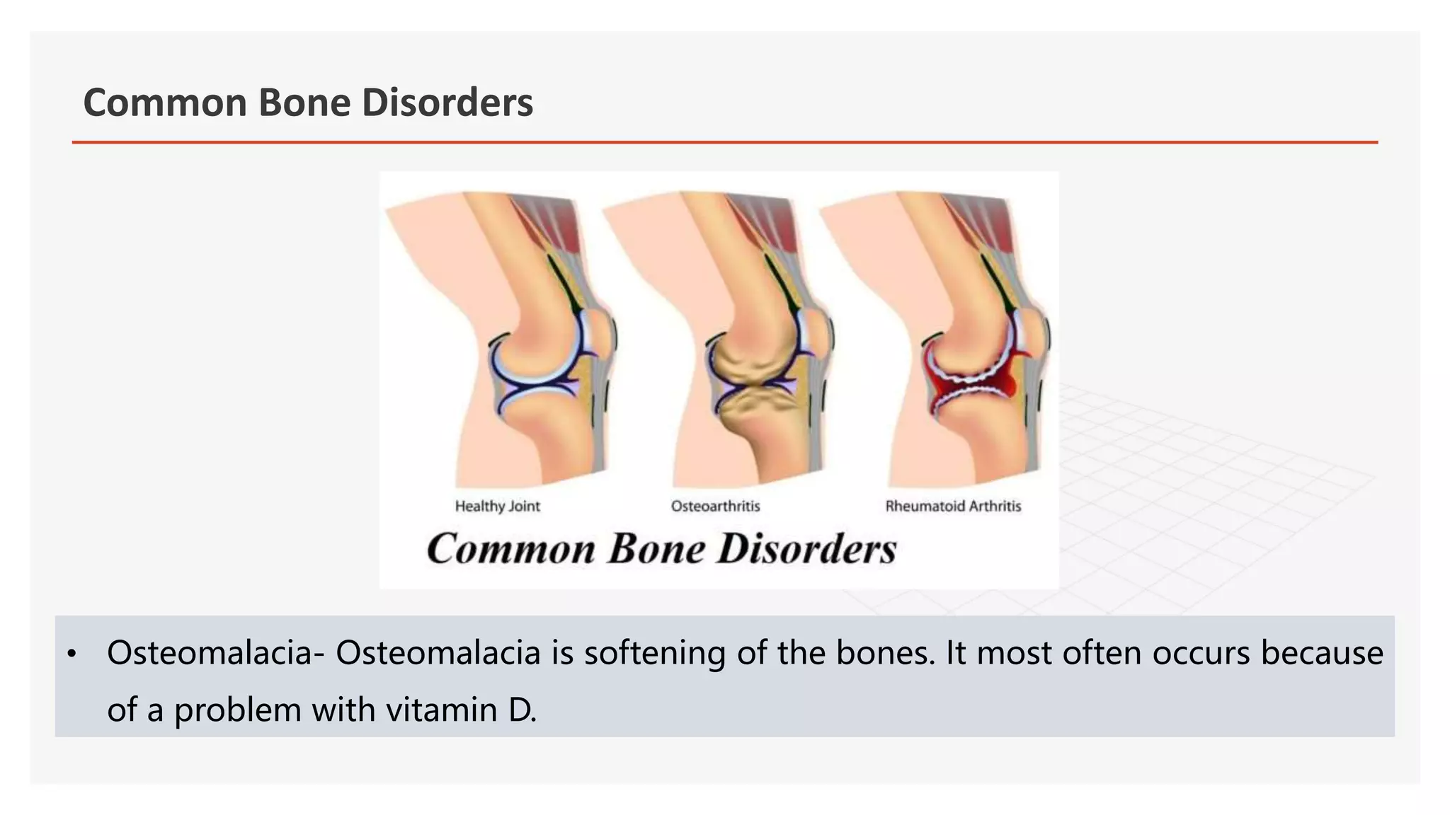 Common Bone Disorders | PPTX