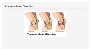 Common Bone Disorders
 