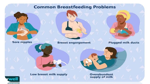 Common breast feeding problems in postpartum period and their solutions ...