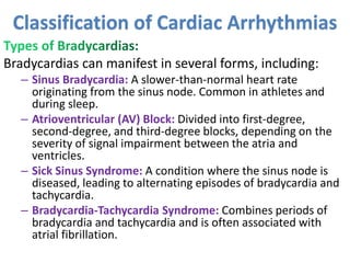 Bradycardias can manifest in several forms, including:
– Sinus Bradycardia: A slower-than-normal heart rate
originating from the sinus node. Common in athletes and
during sleep.
– Atrioventricular (AV) Block: Divided into first-degree,
second-degree, and third-degree blocks, depending on the
severity of signal impairment between the atria and
ventricles.
– Sick Sinus Syndrome: A condition where the sinus node is
diseased, leading to alternating episodes of bradycardia and
tachycardia.
– Bradycardia-Tachycardia Syndrome: Combines periods of
bradycardia and tachycardia and is often associated with
atrial fibrillation.
Classification of Cardiac Arrhythmias
 