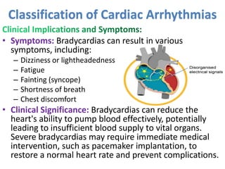 • Symptoms: Bradycardias can result in various
symptoms, including:
– Dizziness or lightheadedness
– Fatigue
– Fainting (syncope)
– Shortness of breath
– Chest discomfort
• Clinical Significance: Bradycardias can reduce the
heart's ability to pump blood effectively, potentially
leading to insufficient blood supply to vital organs.
Severe bradycardias may require immediate medical
intervention, such as pacemaker implantation, to
restore a normal heart rate and prevent complications.
Classification of Cardiac Arrhythmias
 