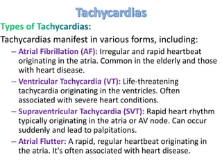 Tachycardias manifest in various forms, including:
– Atrial Fibrillation (AF): Irregular and rapid heartbeat
originating in the atria. Common in the elderly and those
with heart disease.
– Ventricular Tachycardia (VT): Life-threatening
tachycardia originating in the ventricles. Often
associated with severe heart conditions.
– Supraventricular Tachycardia (SVT): Rapid heart rhythm
typically originating in the atria or AV node. Can occur
suddenly and lead to palpitations.
– Atrial Flutter: A rapid, regular heartbeat originating in
the atria. It's often associated with heart disease.
 