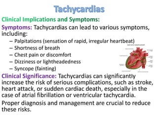 Symptoms: Tachycardias can lead to various symptoms,
including:
– Palpitations (sensation of rapid, irregular heartbeat)
– Shortness of breath
– Chest pain or discomfort
– Dizziness or lightheadedness
– Syncope (fainting)
Clinical Significance: Tachycardias can significantly
increase the risk of serious complications, such as stroke,
heart attack, or sudden cardiac death, especially in the
case of atrial fibrillation or ventricular tachycardia.
Proper diagnosis and management are crucial to reduce
these risks.
 
