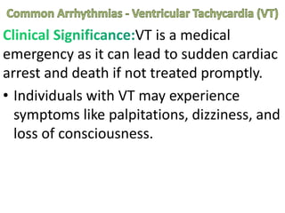 VT is a medical
emergency as it can lead to sudden cardiac
arrest and death if not treated promptly.
• Individuals with VT may experience
symptoms like palpitations, dizziness, and
loss of consciousness.
 