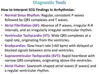How to Interpret ECG Findings in Arrhythmias:
• Normal Sinus Rhythm: Regular, consistent P waves
followed by QRS complexes and T waves.
• Atrial Fibrillation (AF): Absence of P waves, irregular R-R
intervals, and an irregularly irregular ventricular rhythm.
• Ventricular Tachycardia (VT): Wide QRS complexes at a
rapid rate, originating from the ventricles.
• Bradycardias: Slow heart rate (<60 bpm) with delayed or
blocked signals between atria and ventricles.
• Supraventricular Tachycardia (SVT): Rapid heartbeat with
narrow QRS complexes, originating above the ventricles.
• Atrial Flutter: Sawtooth-shaped atrial waves (F waves) and
a regular ventricular rhythm.
 