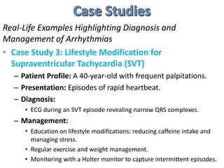 Real-Life Examples Highlighting Diagnosis and
Management of Arrhythmias
• Case Study 3: Lifestyle Modification for
Supraventricular Tachycardia (SVT)
– Patient Profile: A 40-year-old with frequent palpitations.
– Presentation: Episodes of rapid heartbeat.
– Diagnosis:
• ECG during an SVT episode revealing narrow QRS complexes.
– Management:
• Education on lifestyle modifications: reducing caffeine intake and
managing stress.
• Regular exercise and weight management.
• Monitoring with a Holter monitor to capture intermittent episodes.
 