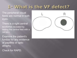 The peripheral visual
fields are normal in both
eyes.
There is a right central
scotoma (revealed by
testing the central field with a
red pin).
Examine the patient's
fundus for any evidence
of papillitis or optic
atrophy.
Check for RAPD.
 