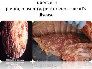 Tubercle in
pleura, masentry, peritoneum – pearl’s
disease

Friday, October 18, 2013

Dr.Pavulraj.S, (original author) M.V.Sc.,
Pathology scholar, IVRI(NRCE), India

11

 